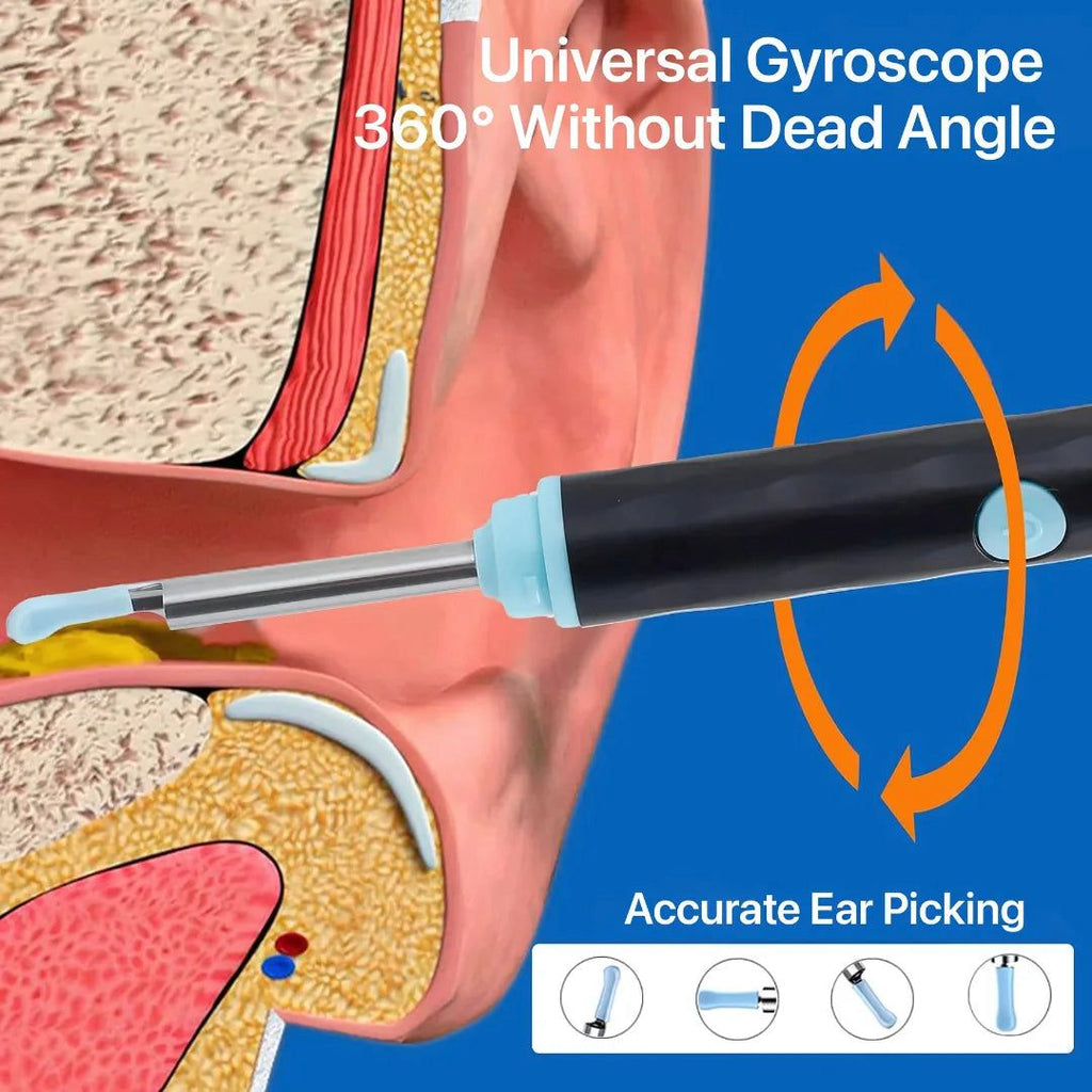 EARWAX CLEANER WITH CAMERA