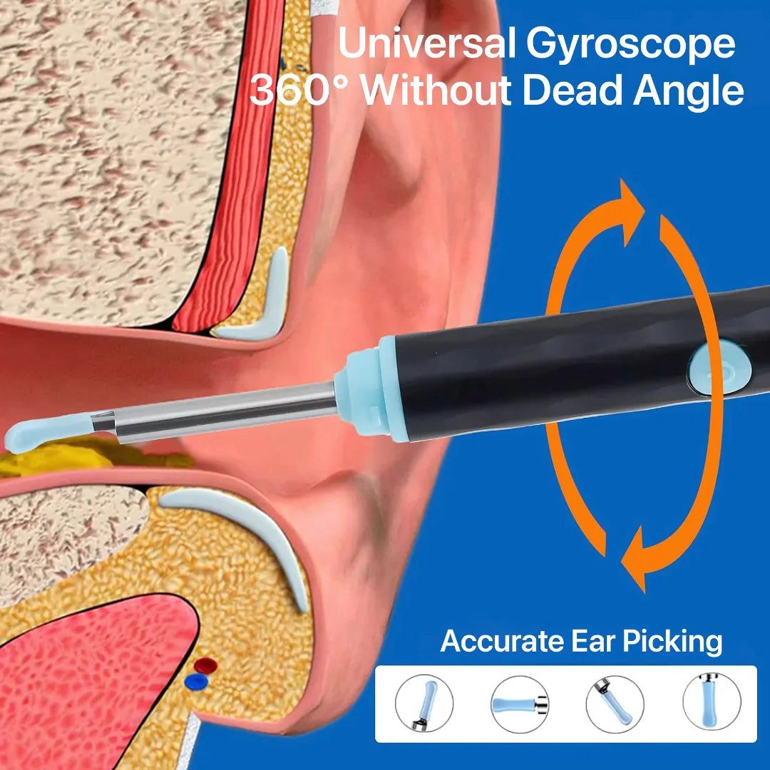 EARWAX CLEANER WITH CAMERA