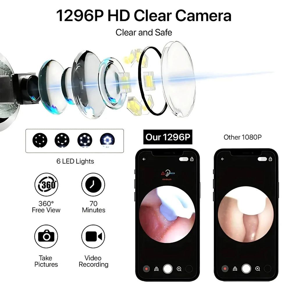 EARWAX CLEANER WITH CAMERA