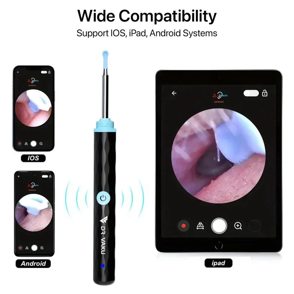 EARWAX CLEANER WITH CAMERA